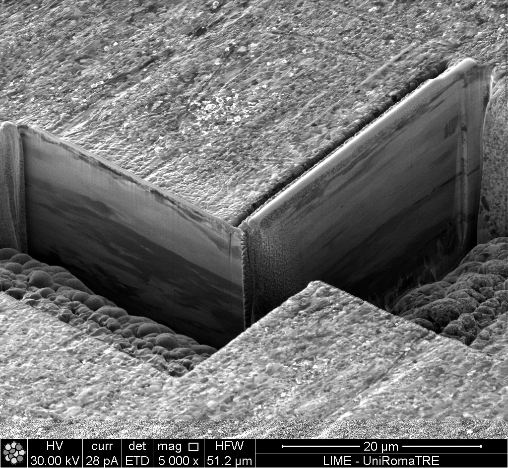SEM/FIB micrograph